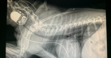 Preston's Pacemaker Xray