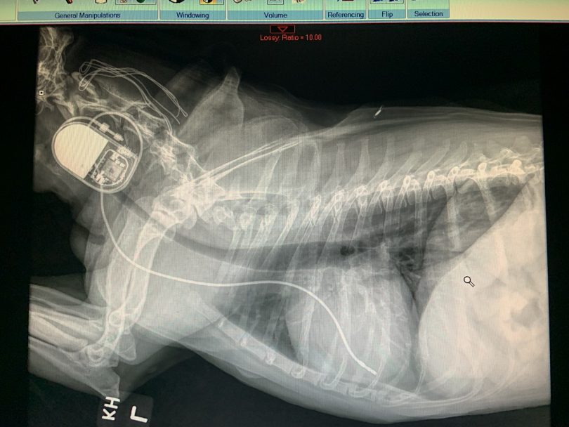 Preston's Pacemaker Xray